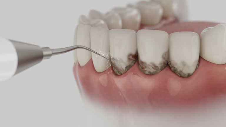 Reliable Dental contractor in Bunkie, LA by Dentist Open Now